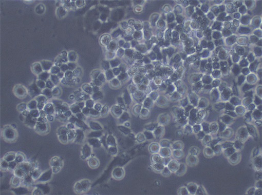 図２　培養中の癌細胞（位相差顕微鏡像）